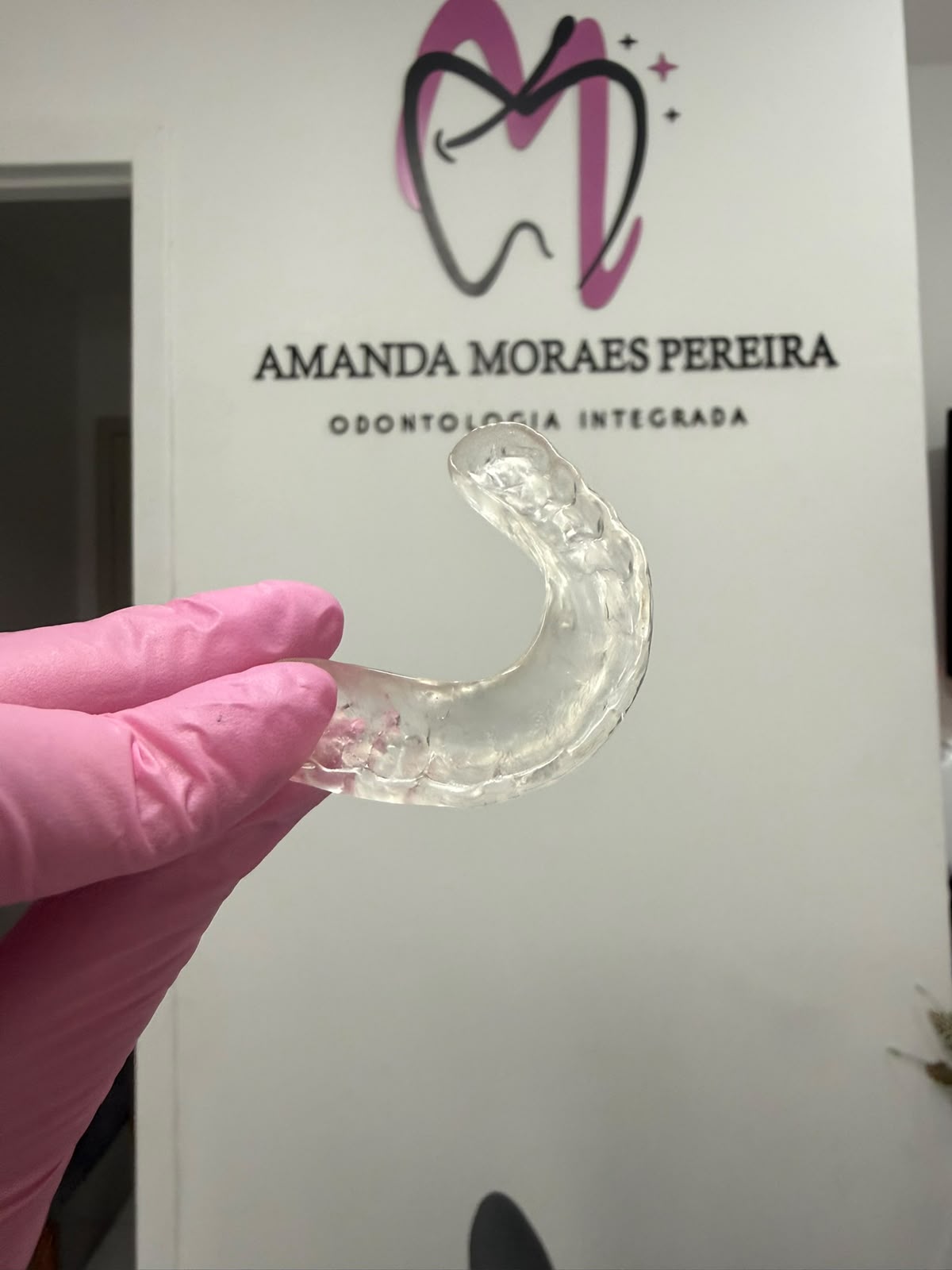 Placa de bruxismo personalizada segurada com luva